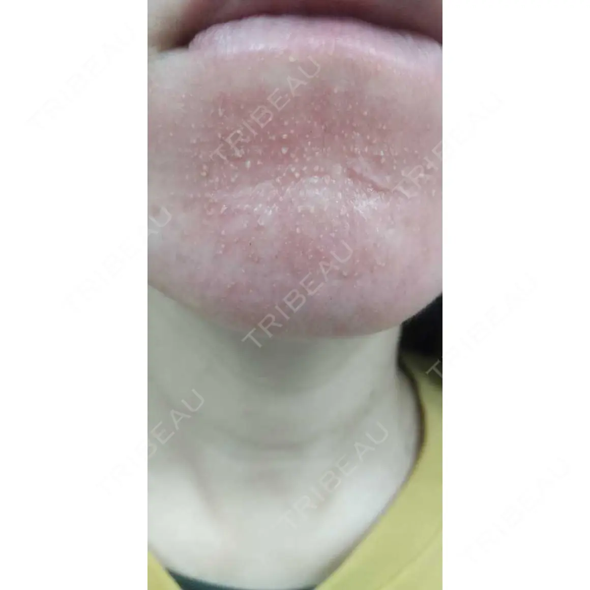 ポテンツァ 9BeautyClinic AFTER