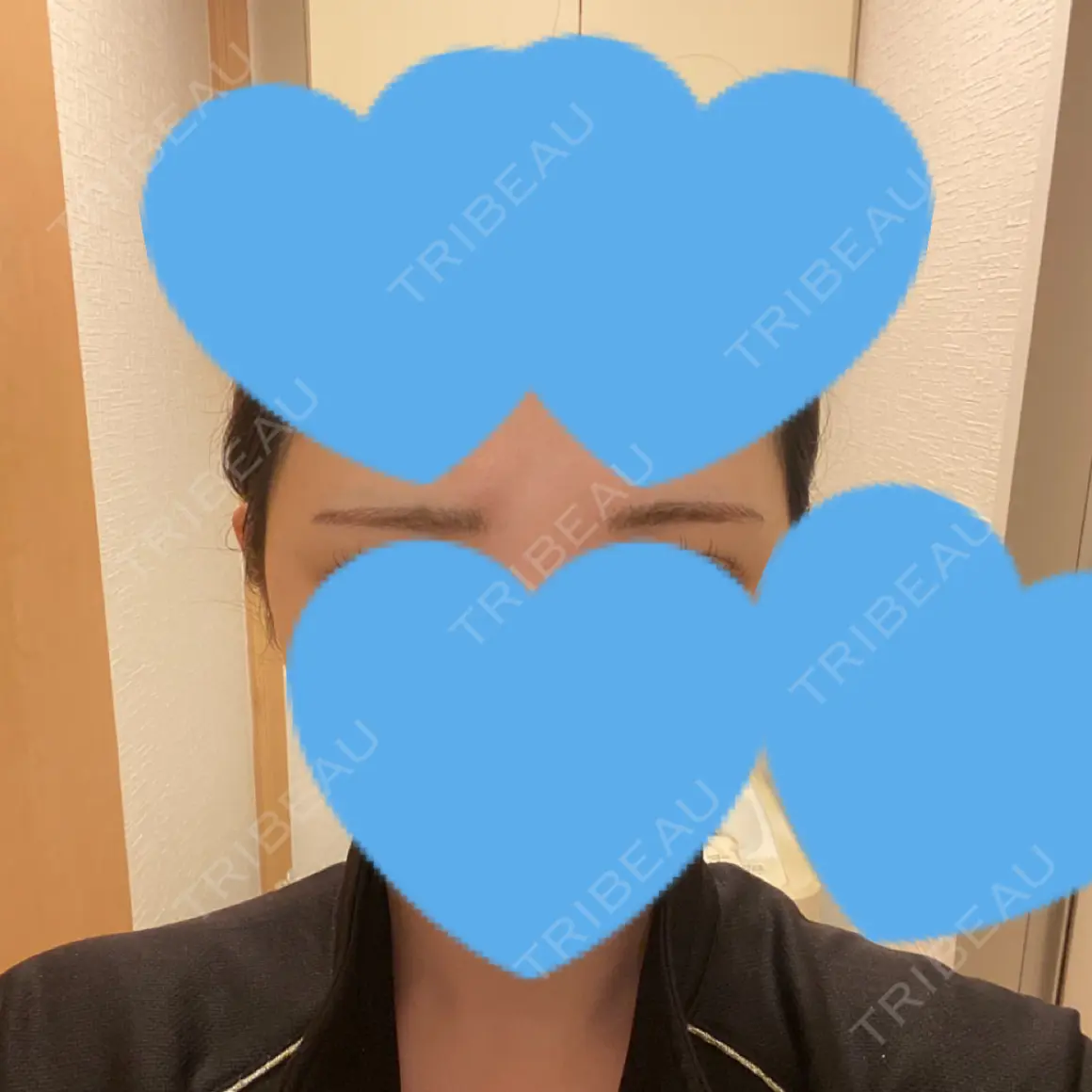 アートメイク（眉） 表参道メディカルクリニック 福岡天神院 DAY 0