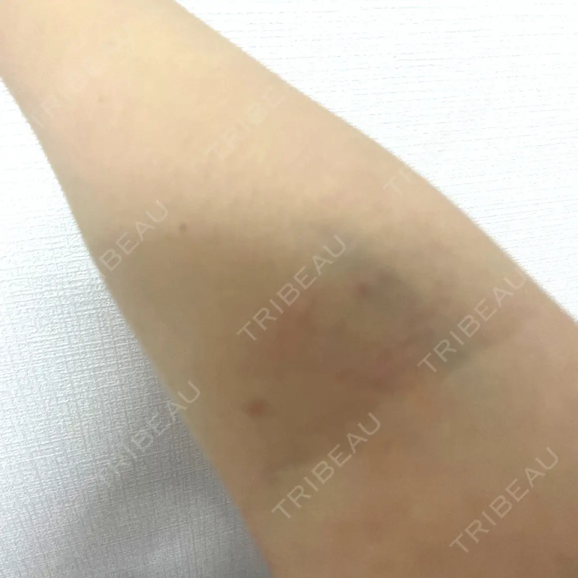 白玉点滴・注射 TCB東京中央美容外科 盛岡院 AFTER