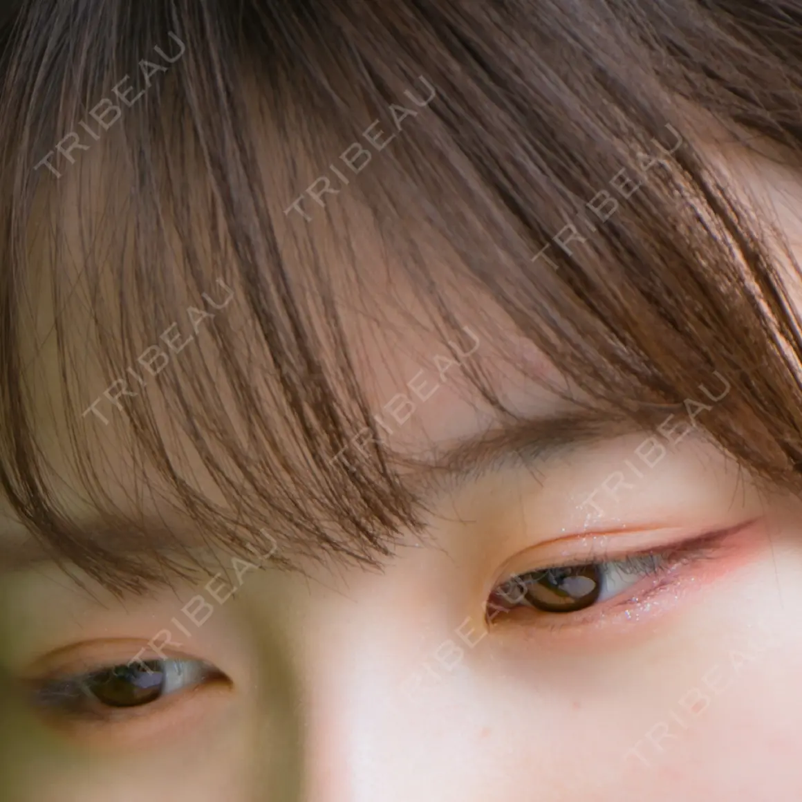 二重埋没 / 上まぶたの脂肪取り / 下まぶたの脂肪取り 東京形成美容外科 船橋院 AFTER
