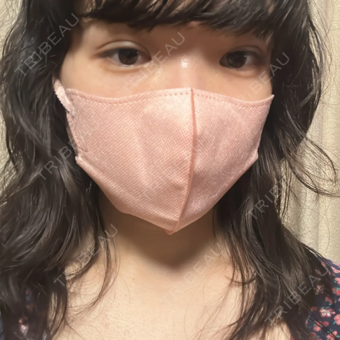 二重埋没 湘南美容クリニック 西葛西院 DAY 0