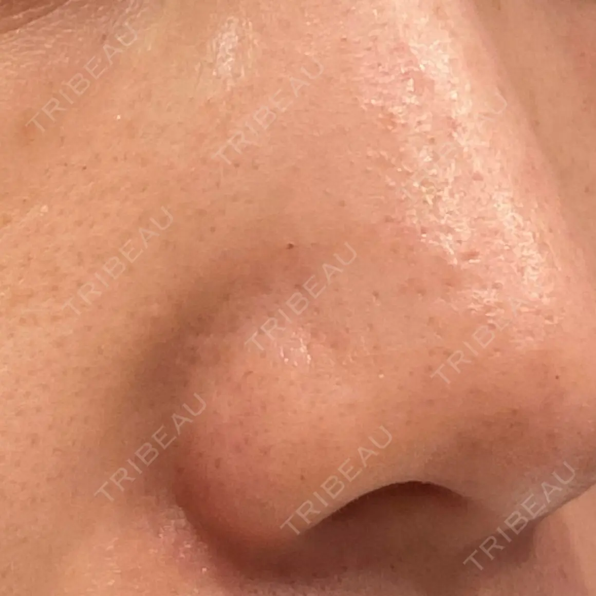 ポテンツァ 9BeautyClinic AFTER