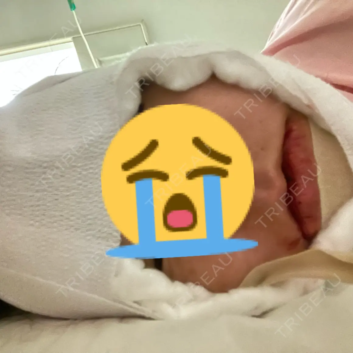 セットバック 大塚美容形成外科・歯科 大塚本院 DAY 0