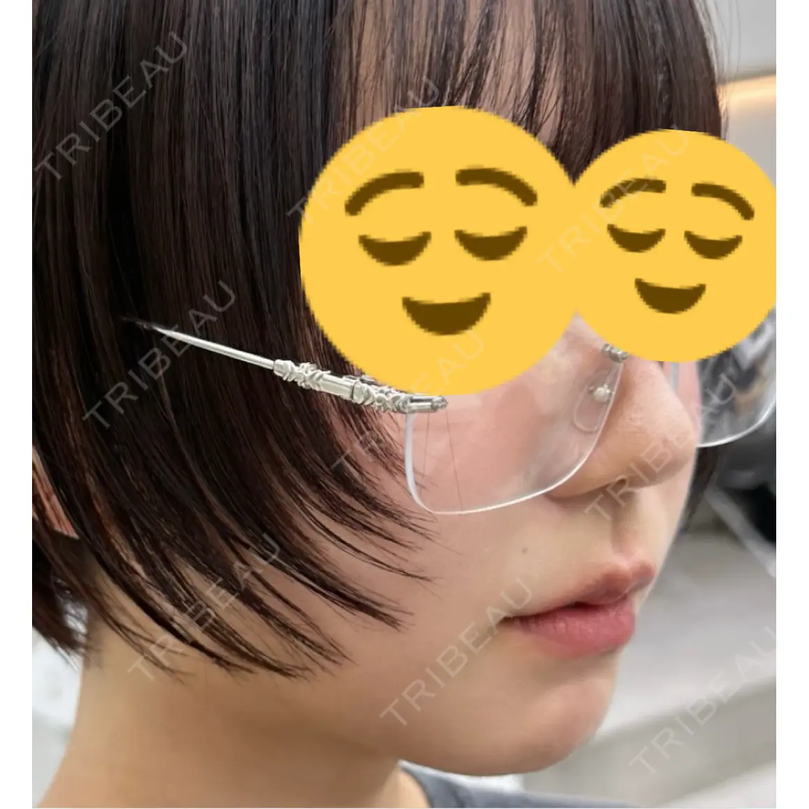 セットバック 大塚美容形成外科・歯科 大塚本院 AFTER