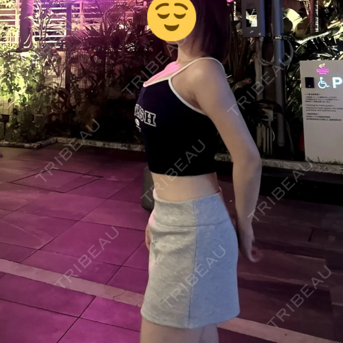 脂肪吸引（お腹） オアシス美容外科 AFTER