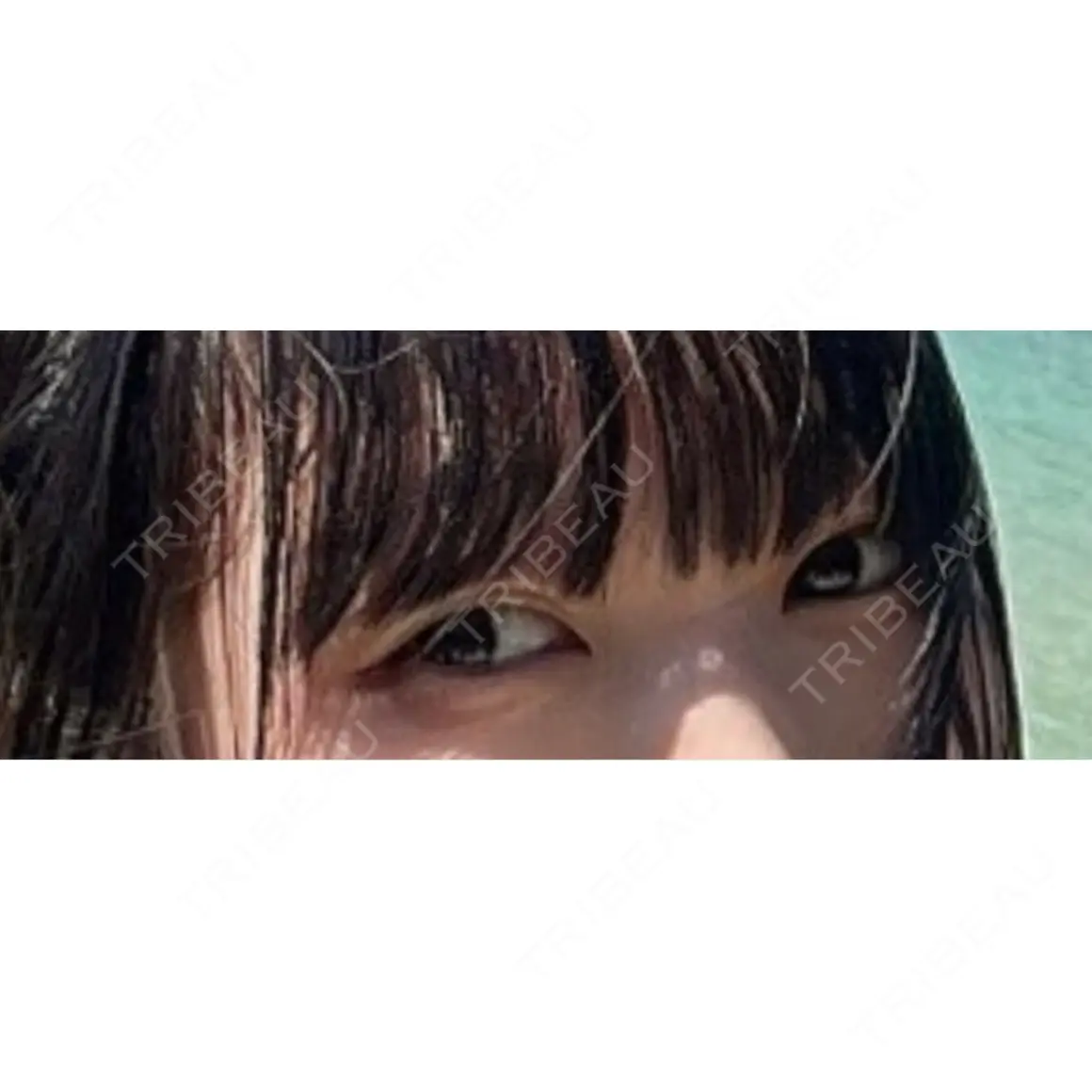二重埋没 アーティスクリニック 西宮 AFTER