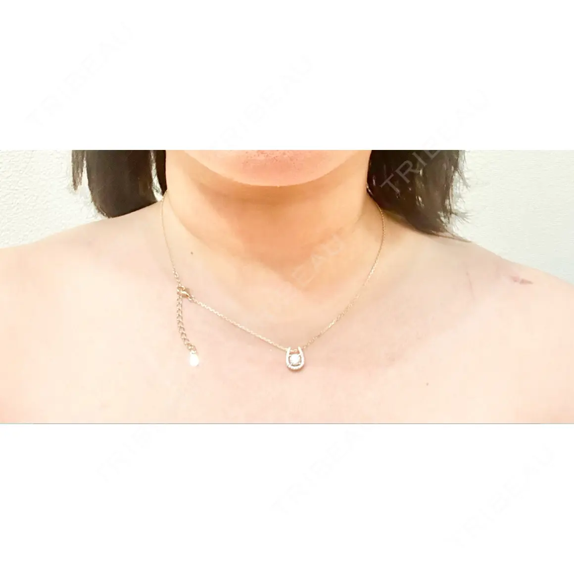 ボトックス（エラ・小顔） / ボトックス（タレ目） / ボトックス（肩） / ボトックス（眉間） / ボトックス（額） / ボトックス（ガミースマイル） / その他（目元） / その他（鼻） メディカルアルファクリニック AFTER