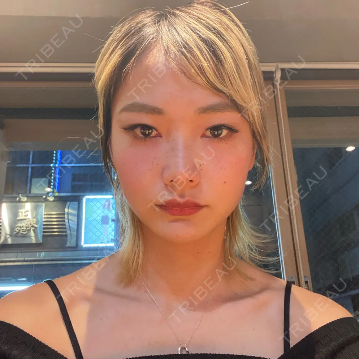 クマ治療 EMMO FACE CLINIC 東京三田院 AFTER