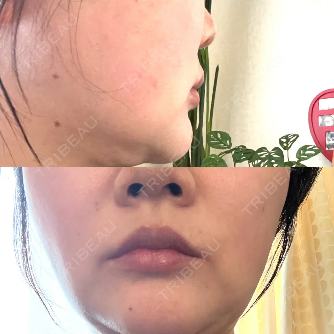その他（輪郭） YAYOI CLINIC AFTER