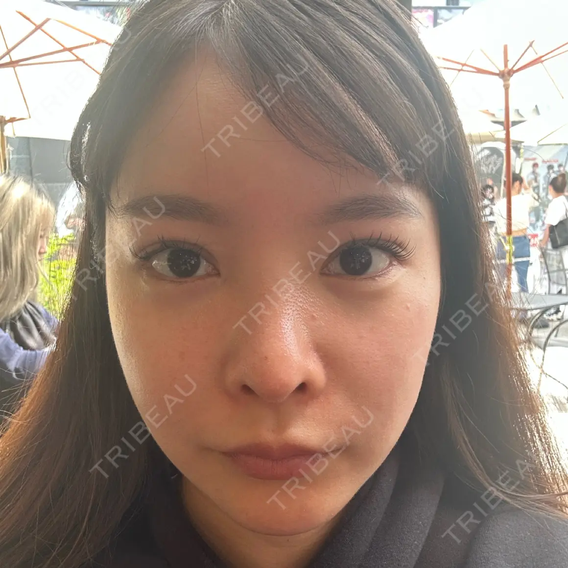 ポテンツァ 9BeautyClinic AFTER