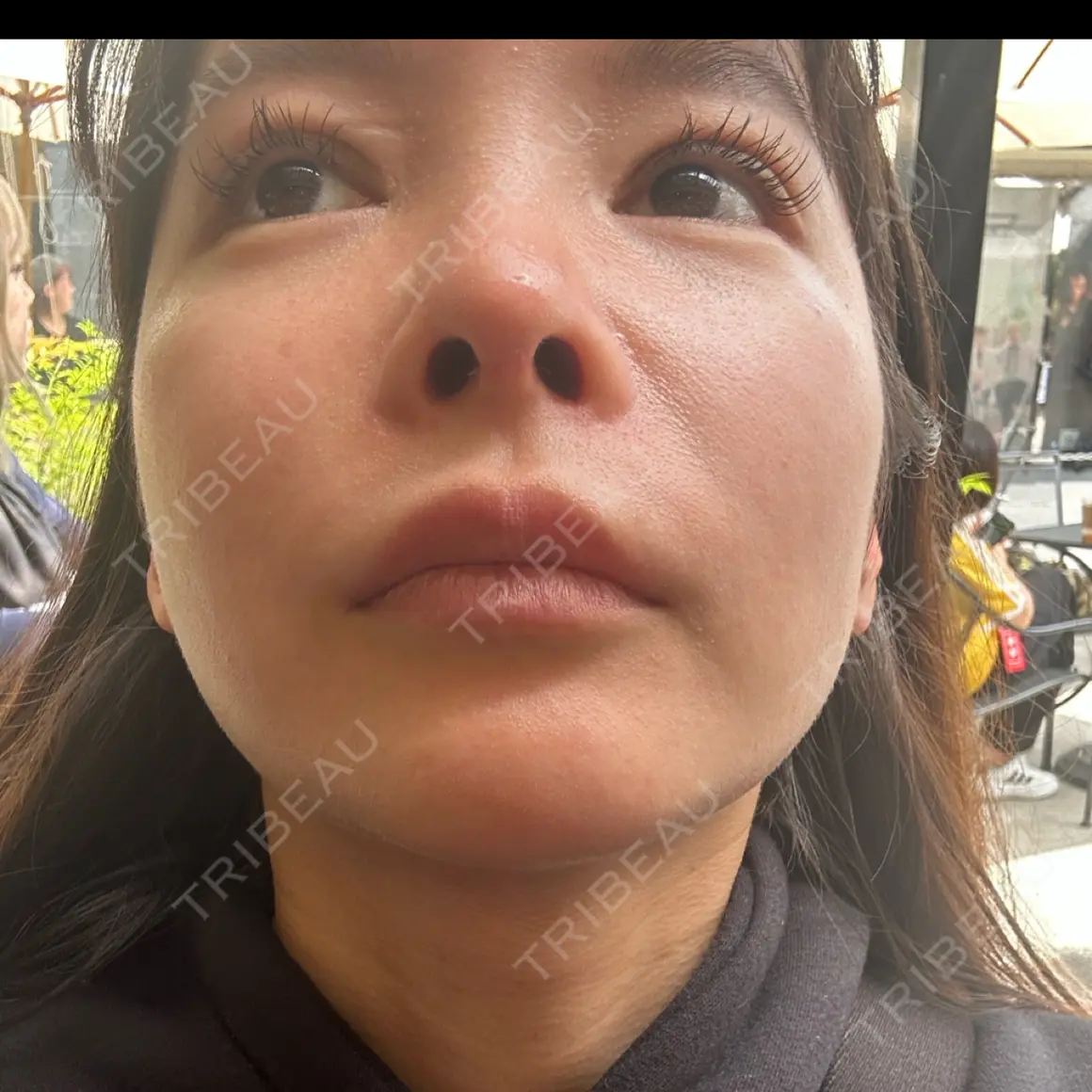 ポテンツァ 9BeautyClinic AFTER