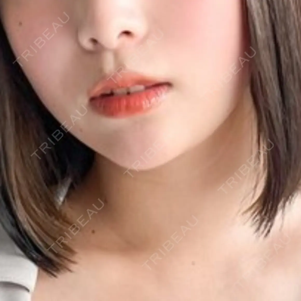 エレクトロポレーション フォンタナクリニック天神 AFTER