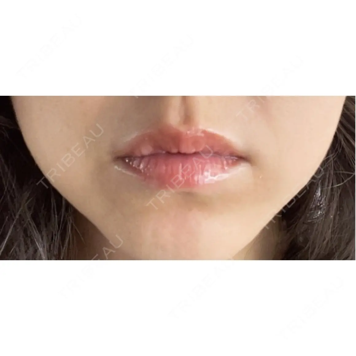 アートメイク（唇） Kinshicho Beauty Clinic （錦糸町ビューティークリニック） AFTER