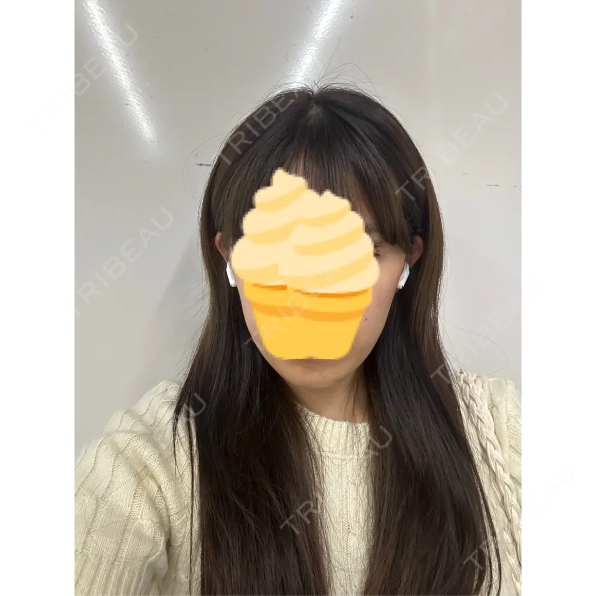 ボトックス（エラ・小顔） TCB東京中央美容外科 金山院 AFTER