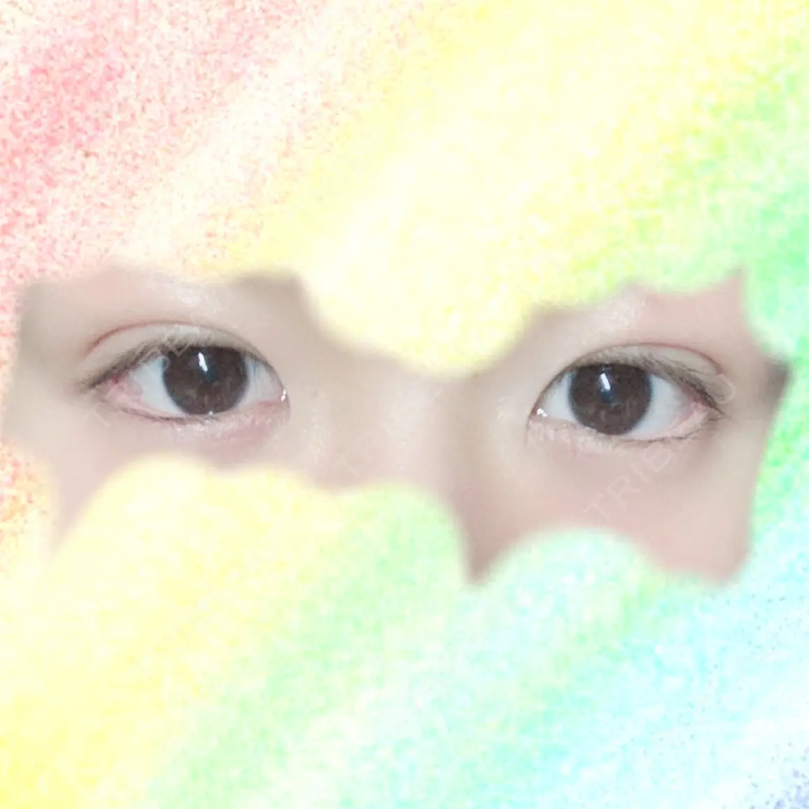 二重埋没 共立美容外科 大宮院 DAY 0