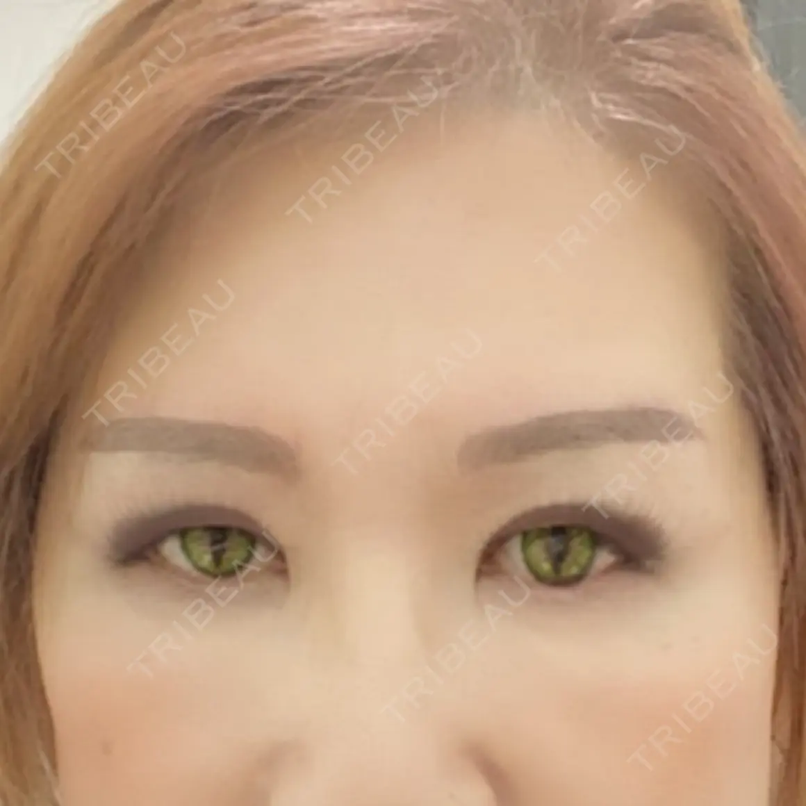 その他  AFTER