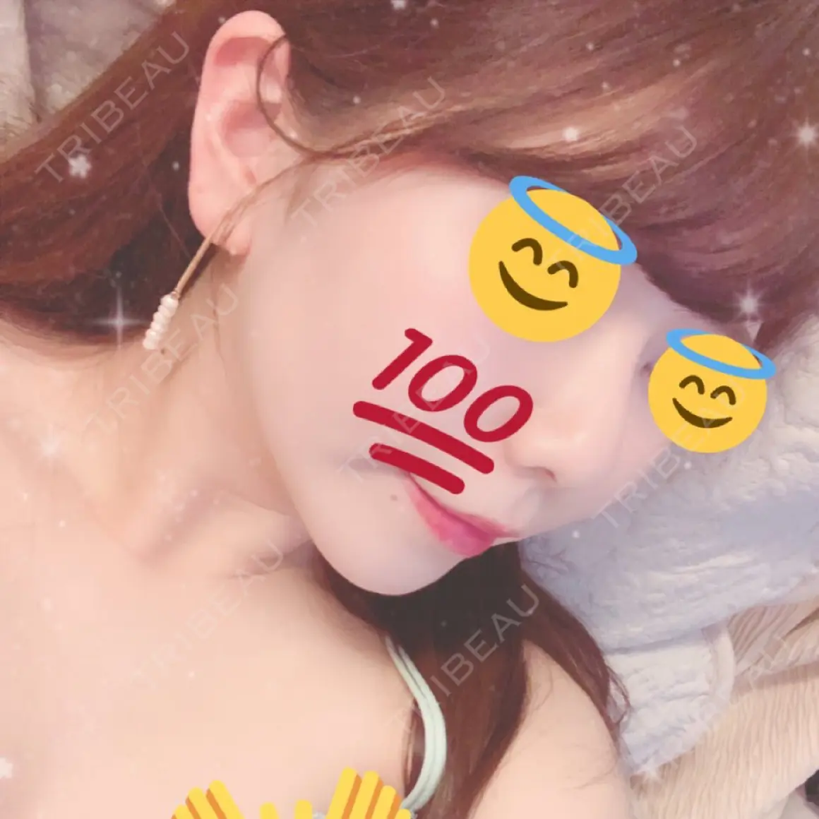 隆鼻術 La Clinique Shinjuku 【ラクリニック 新宿】 AFTER