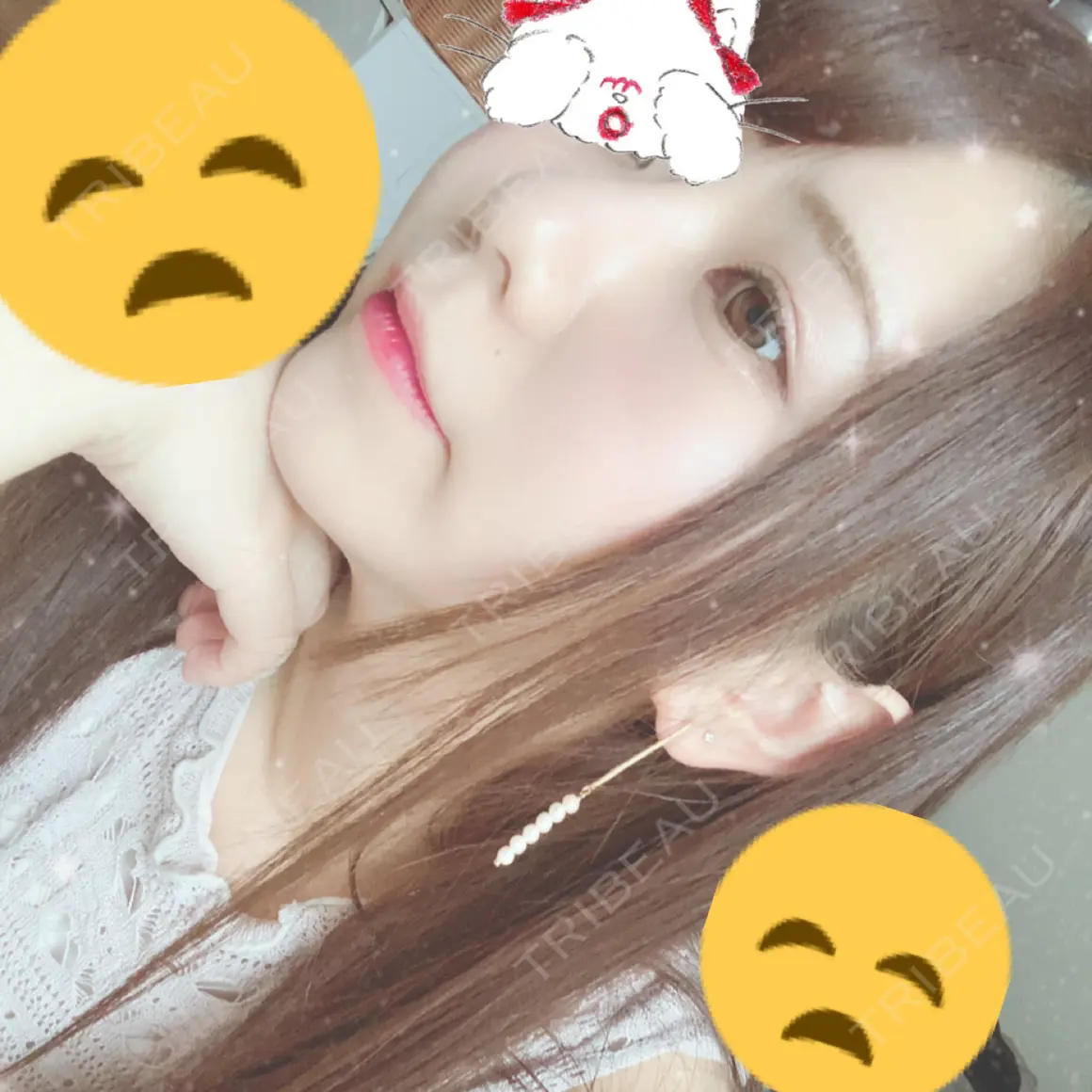 隆鼻術 La Clinique Shinjuku 【ラクリニック 新宿】 AFTER