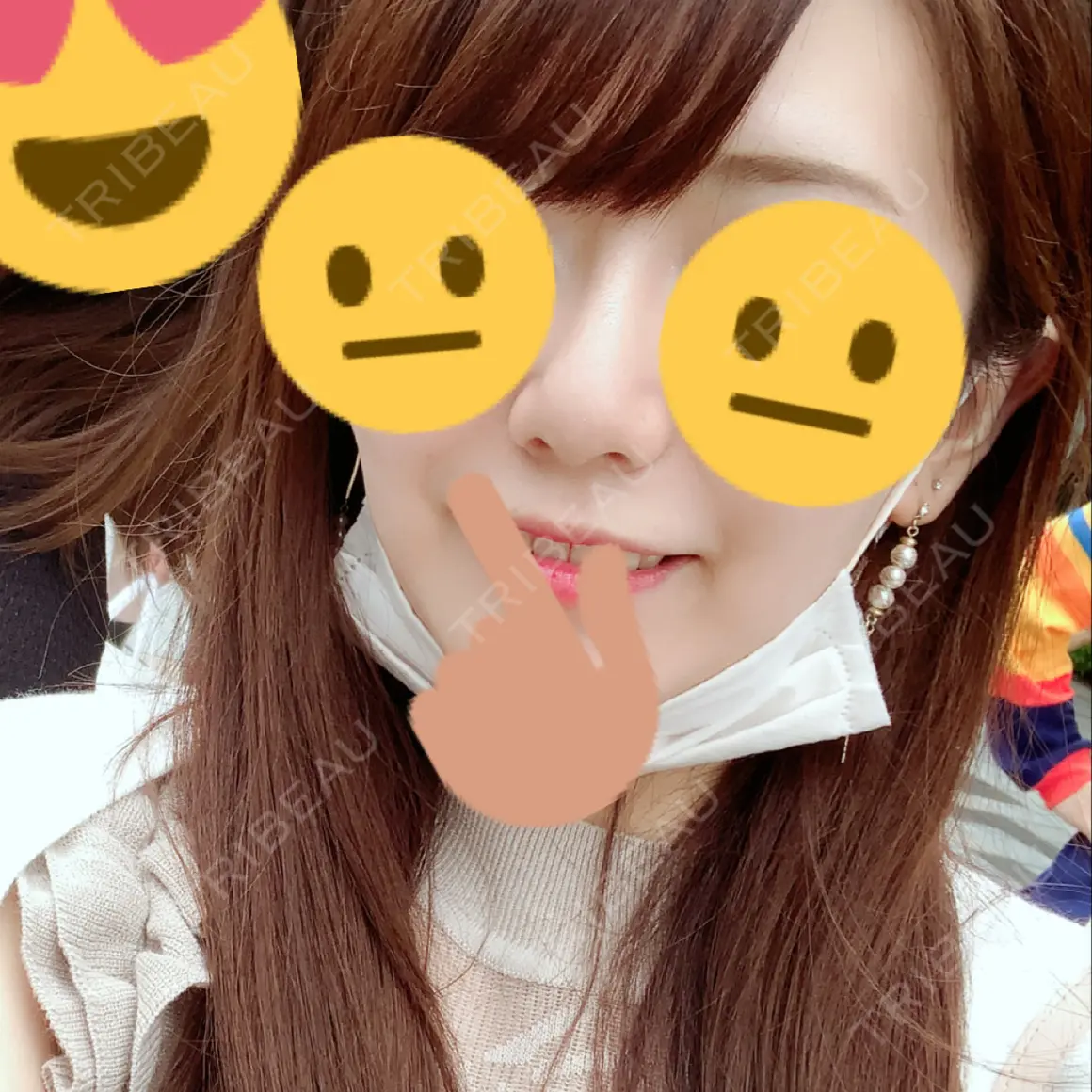 隆鼻術 La Clinique Shinjuku 【ラクリニック 新宿】 AFTER