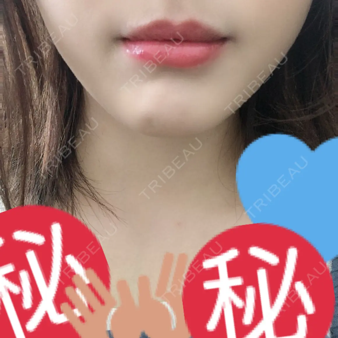 セットバック 大塚美容形成外科・歯科 大塚本院 AFTER