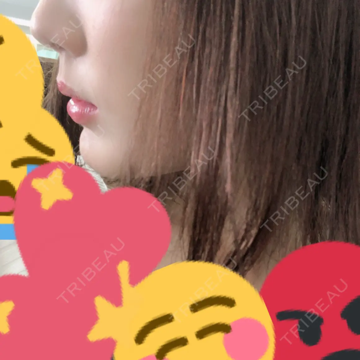 セットバック 大塚美容形成外科・歯科 大塚本院 AFTER
