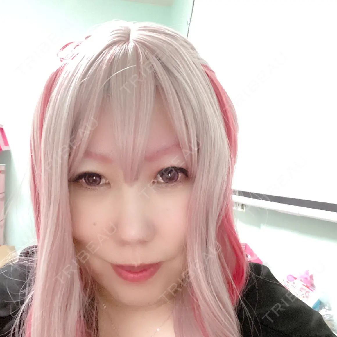 下まぶたの脂肪取り 湘南美容クリニック 千葉センシティ院 AFTER