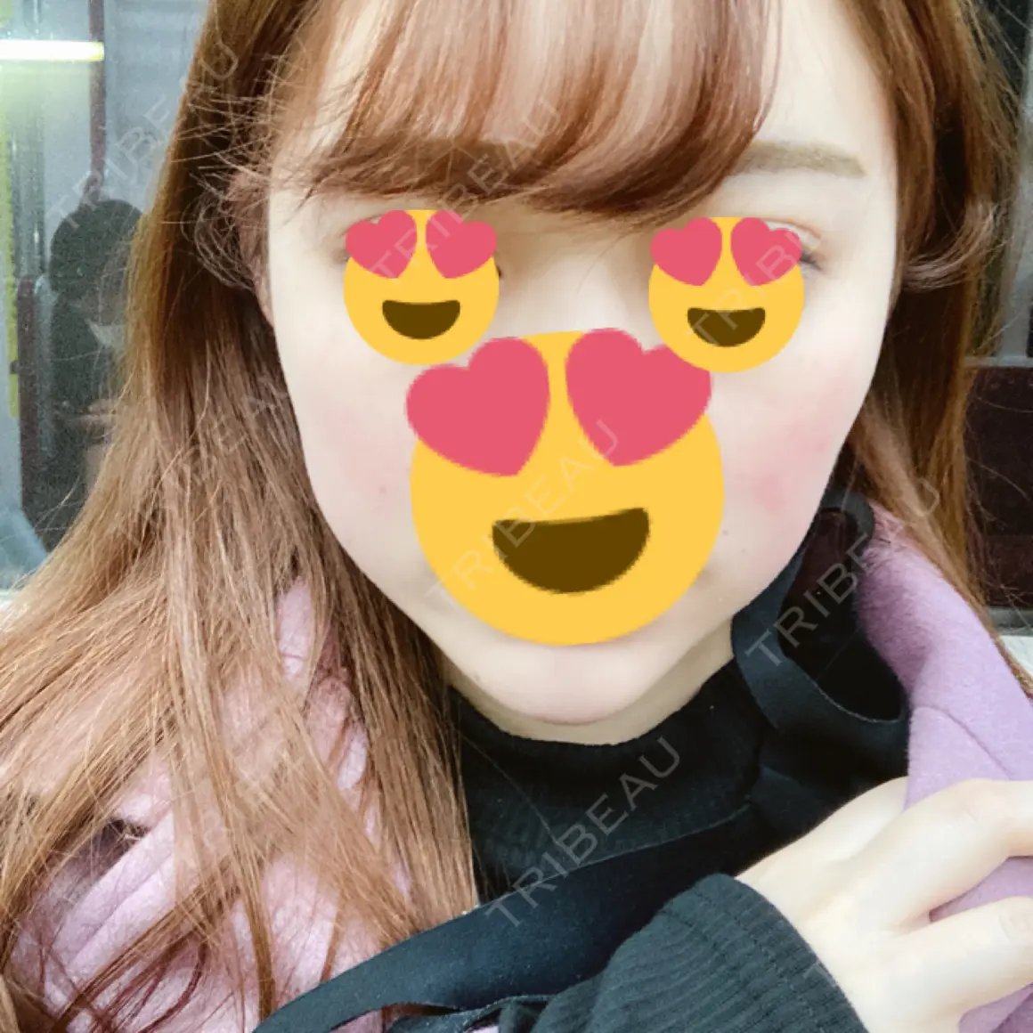 ハイフ（顔） 湘南美容クリニック 新宿本院 DAY 0