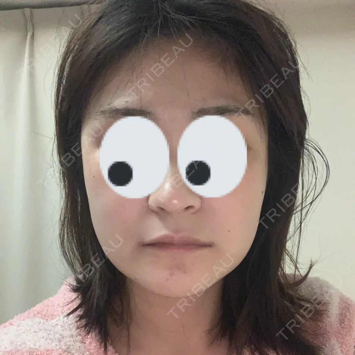 セットバック アーククリニック AFTER