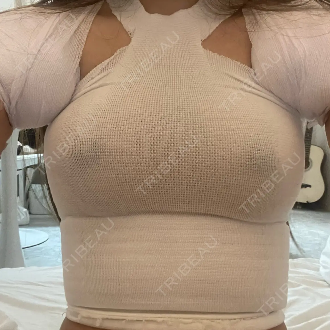 豊胸（シリコンバッグ） 湘南美容クリニック 新宿本院 DAY 1
