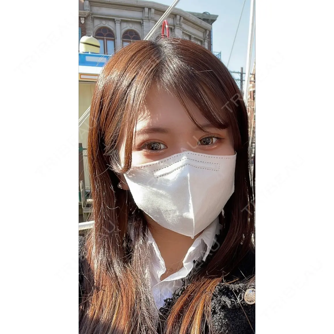 二重埋没 ASTRA BEAUTY CLINIC AFTER