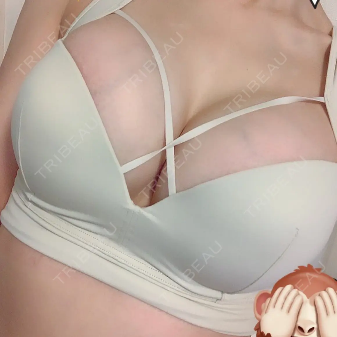 豊胸（シリコンバッグ） あつぎ美容クリニック AFTER
