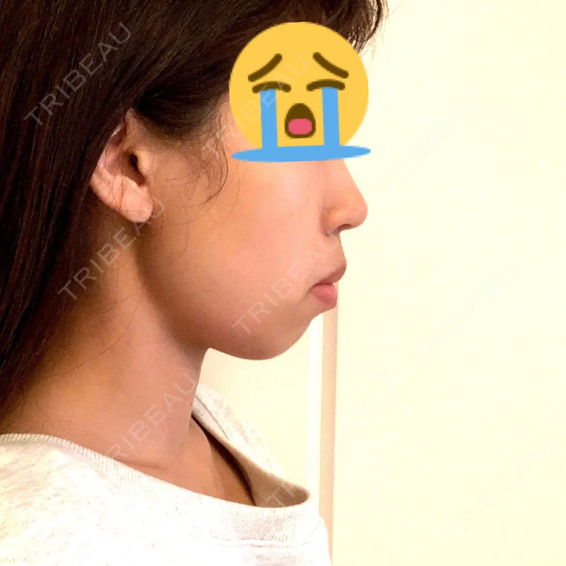 セットバック 大塚美容形成外科・歯科 大塚本院 AFTER