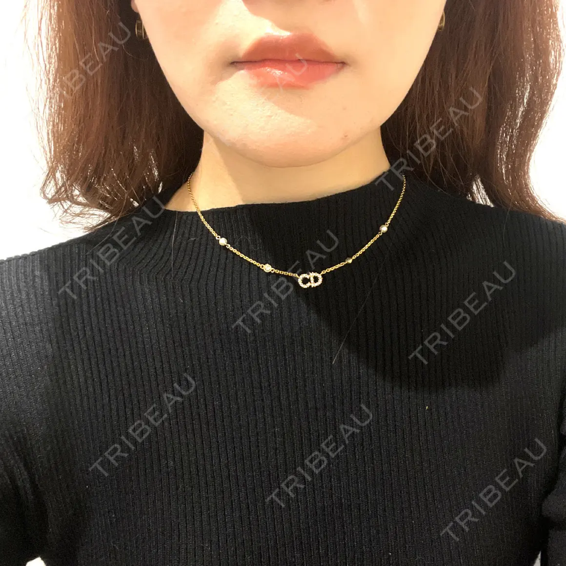 ボトックス（エラ・小顔） 9BeautyClinic AFTER