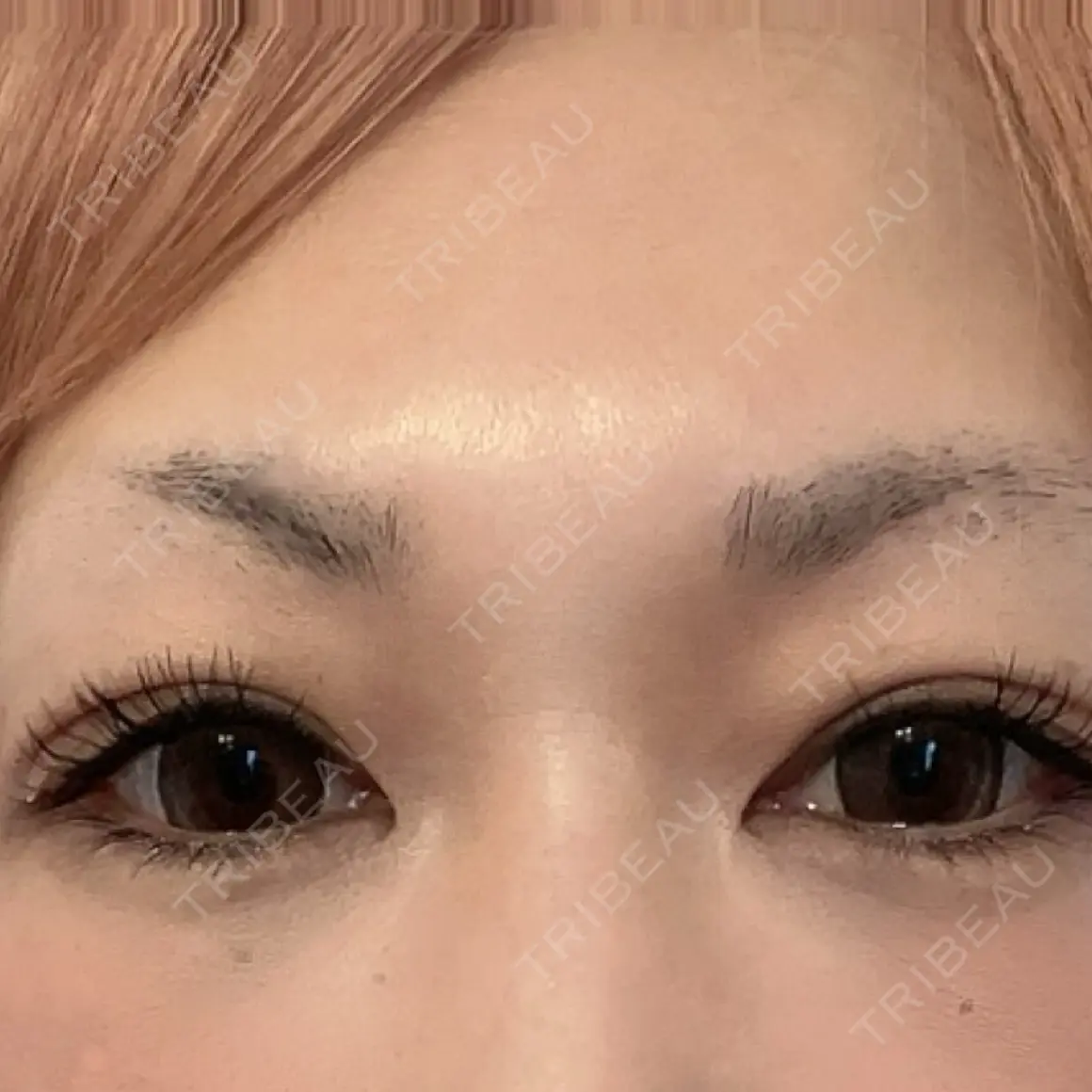 アートメイク（眉） Tokyo Tensei Clinic 新宿院 AFTER