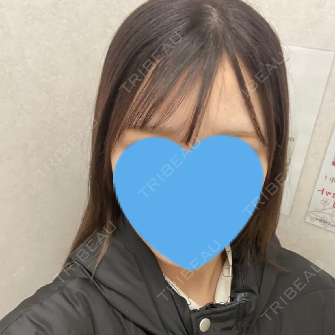 アートメイク（眉） 表参道メディカルクリニック 福岡天神院 AFTER