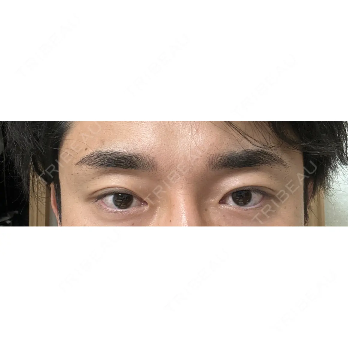 アートメイク（眉） APスキンクリニック銀座 AFTER