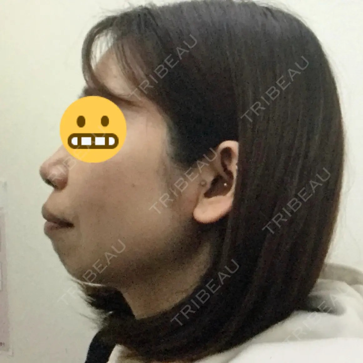 セットバック 大塚美容形成外科・歯科 大塚本院 AFTER