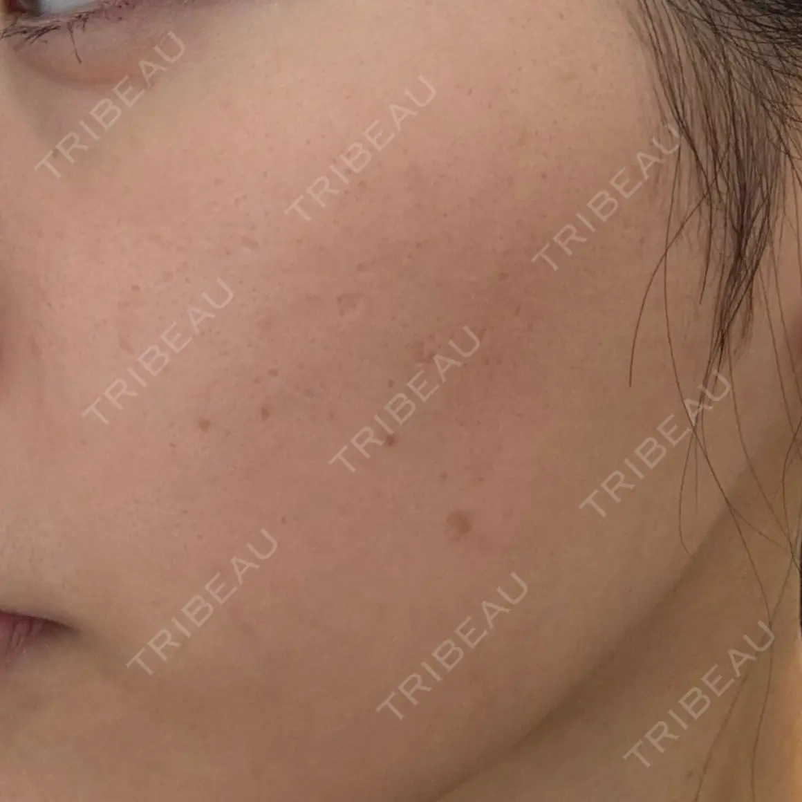 ポテンツァ 9BeautyClinic AFTER