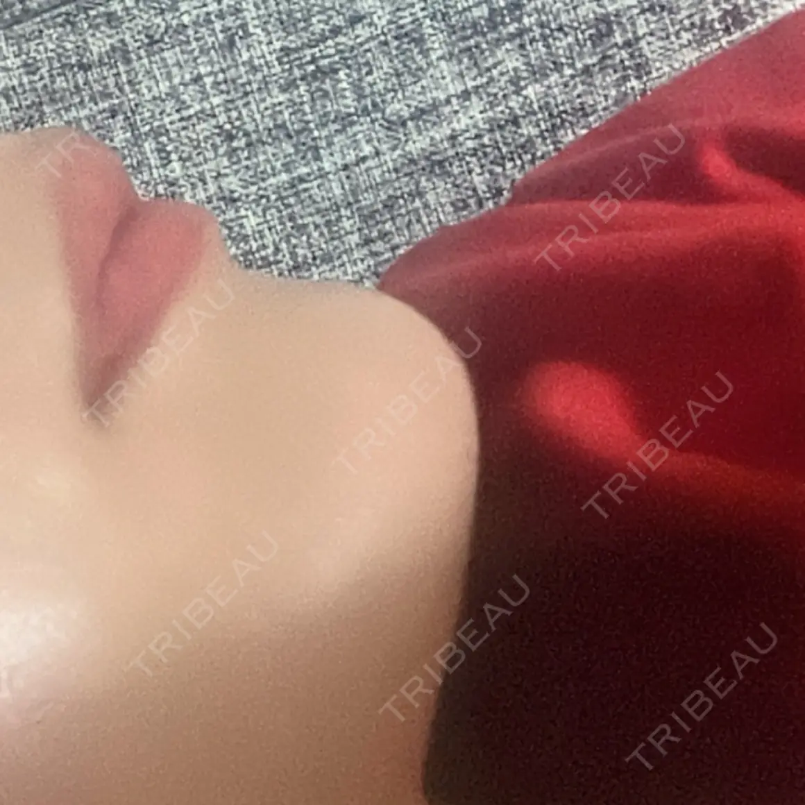 ヒアルロン酸注入（あご） HAAB×DREAM BEAUTY CLINIC 東京本院 AFTER