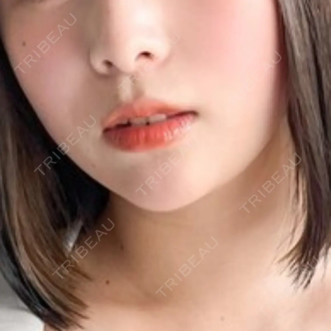 エレクトロポレーション フォンタナクリニック天神 AFTER