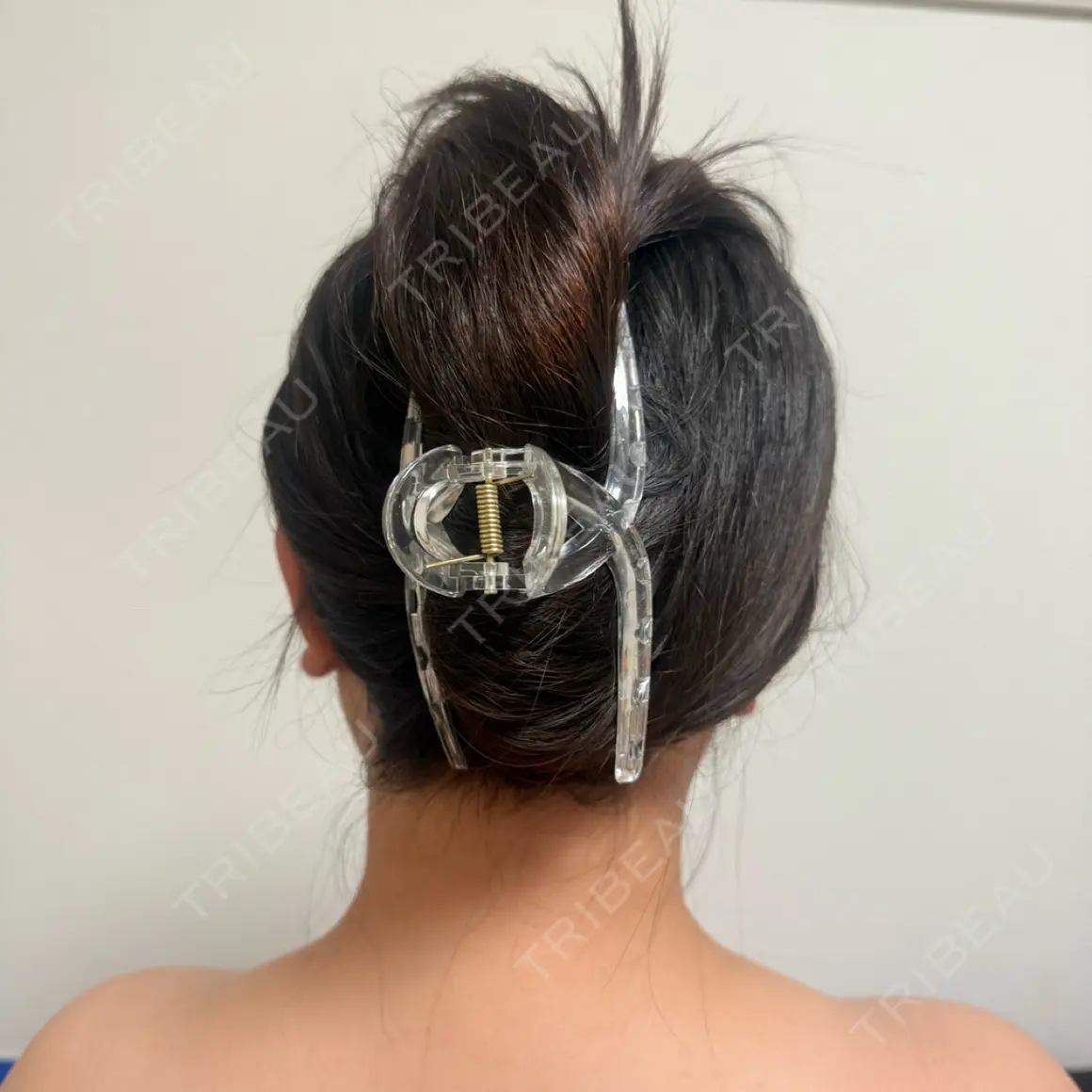 ボトックス（肩） BiBiクリニック AFTER