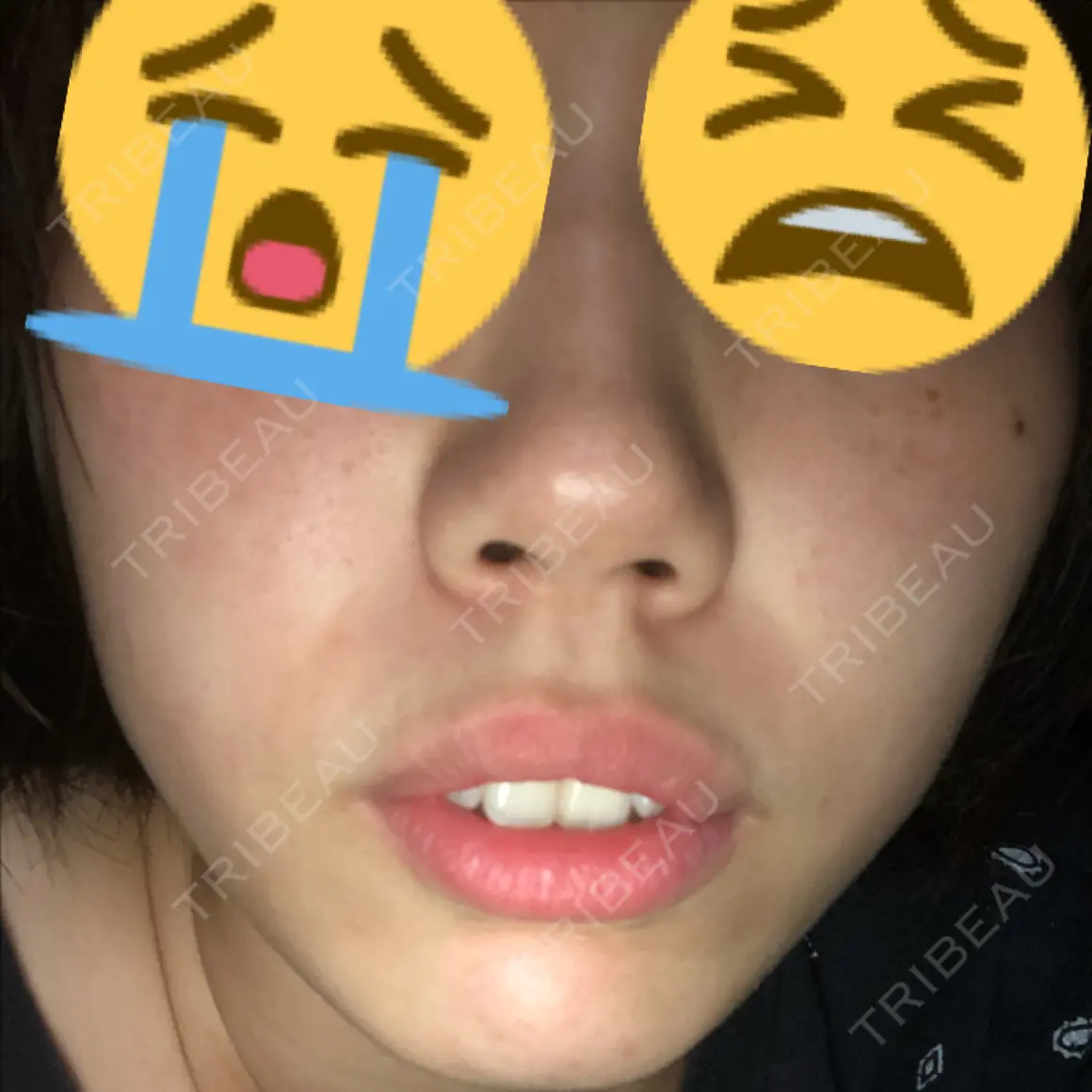 セットバック 大塚美容形成外科・歯科 大塚本院 AFTER