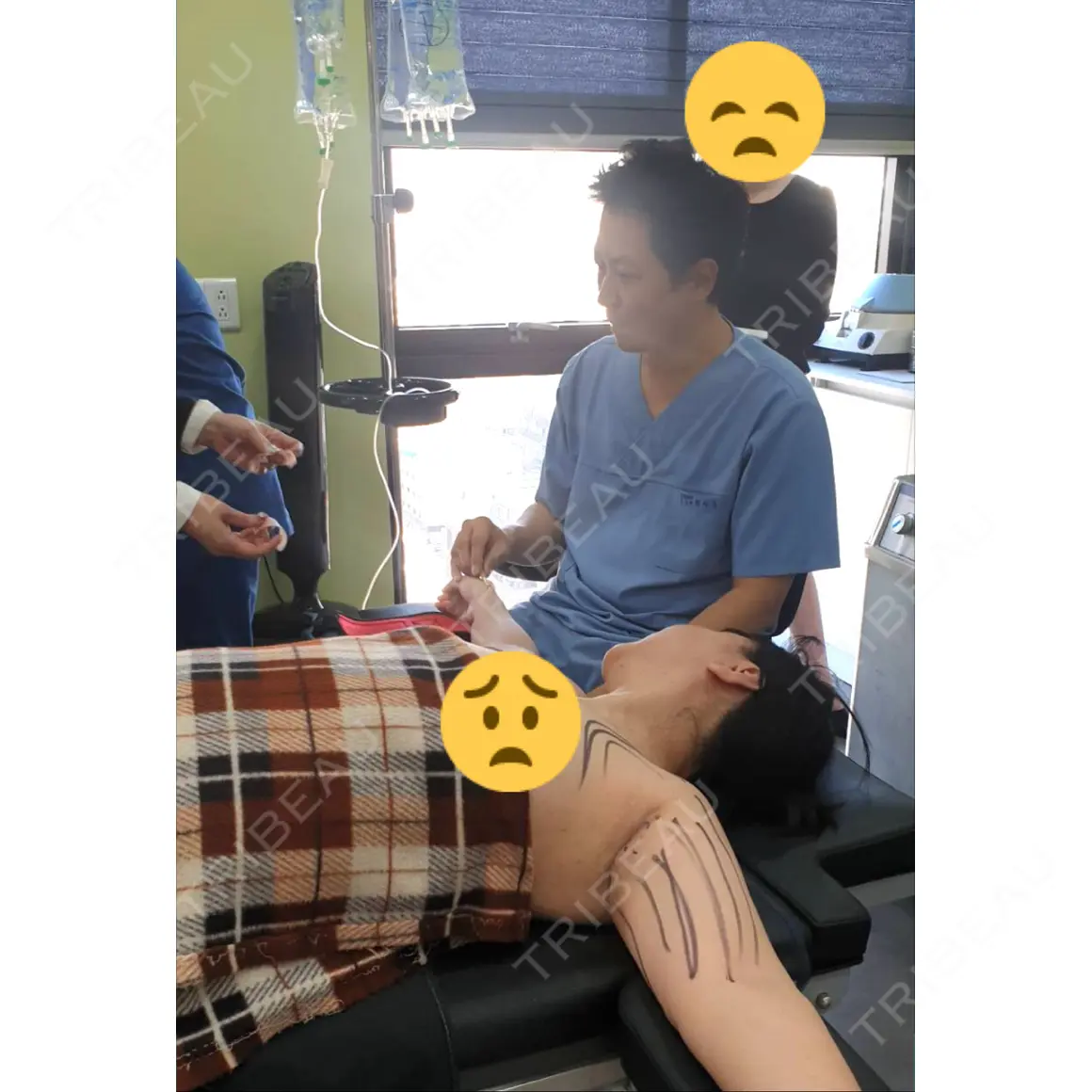 脂肪吸引（脚） REX整形外科 AFTER