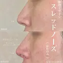 加賀デザイン×スレッドノーズ after画像 サムネイル用
