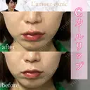 Cカールリップ after画像 サムネイル用