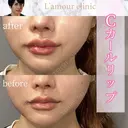 Cカールリップ after画像 サムネイル用