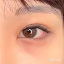 目頭切開＋二重埋没 before画像 サムネイル用