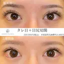 タレ目形成（埋没）+目尻切開 before画像 サムネイル用