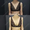 dryuuバスト💕コンデンスリッチ豊胸 7日後 サムネイル用
