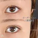 二重まぶた埋没法 before画像 サムネイル用